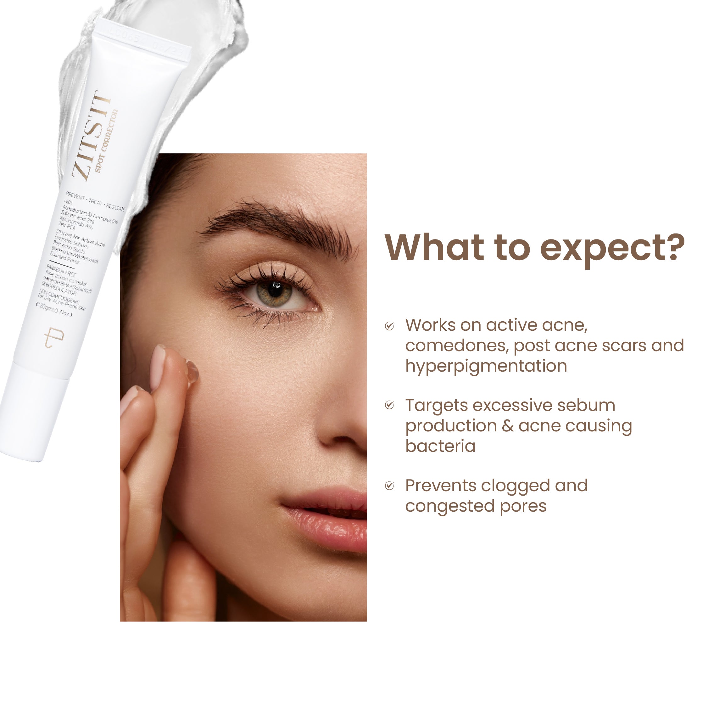 Zitsit Spot Corrector For Active Acne | Acne Scars | Salicylic | Niacinamide | Zinc - Acne Prone & Active Acne | 20g