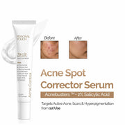 Zitsit Spot Corrector For Active Acne | Acne Scars | Salicylic | Niacinamide | Zinc - Acne Prone & Active Acne | 20g