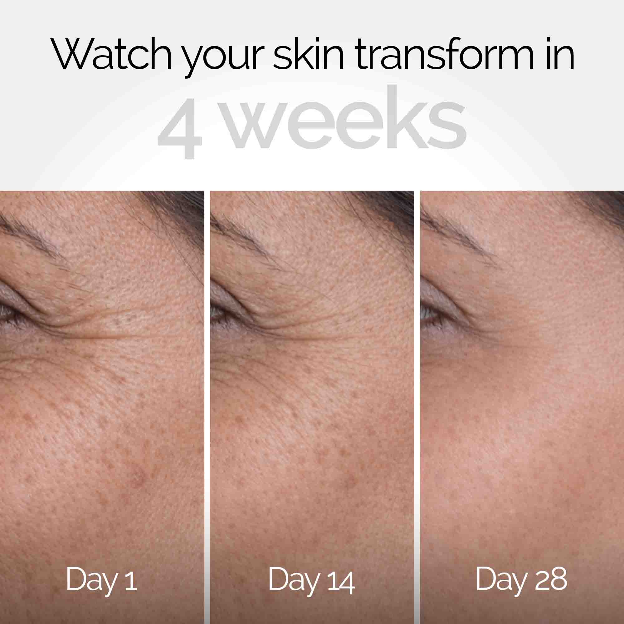 Anti-Ageing Regime - Facebath 100ml, Backshift, Skindam Moisturizer & Feel Me Face & Mini Towel