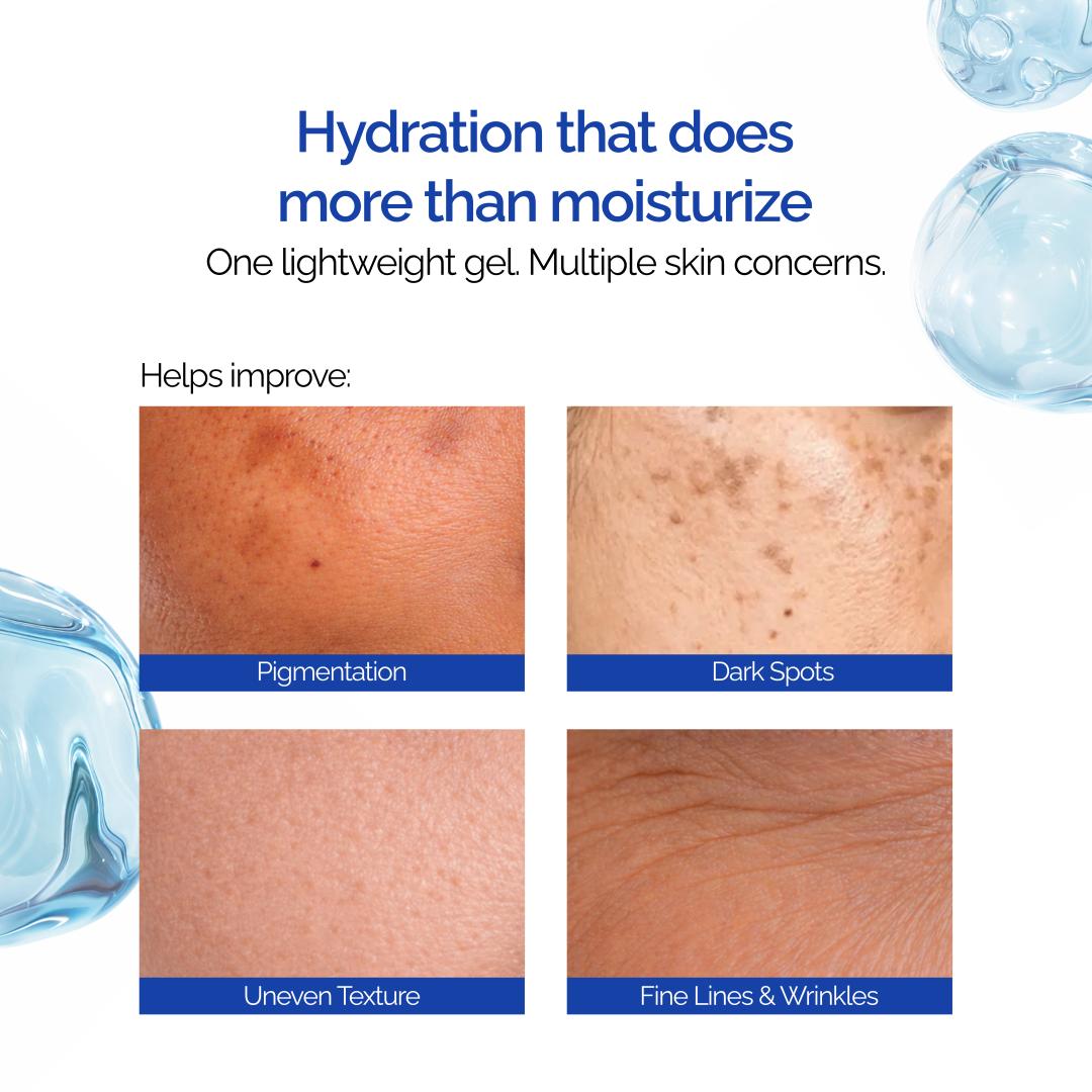 Youthburst Hydrating Water Gel Moisturizer 30g