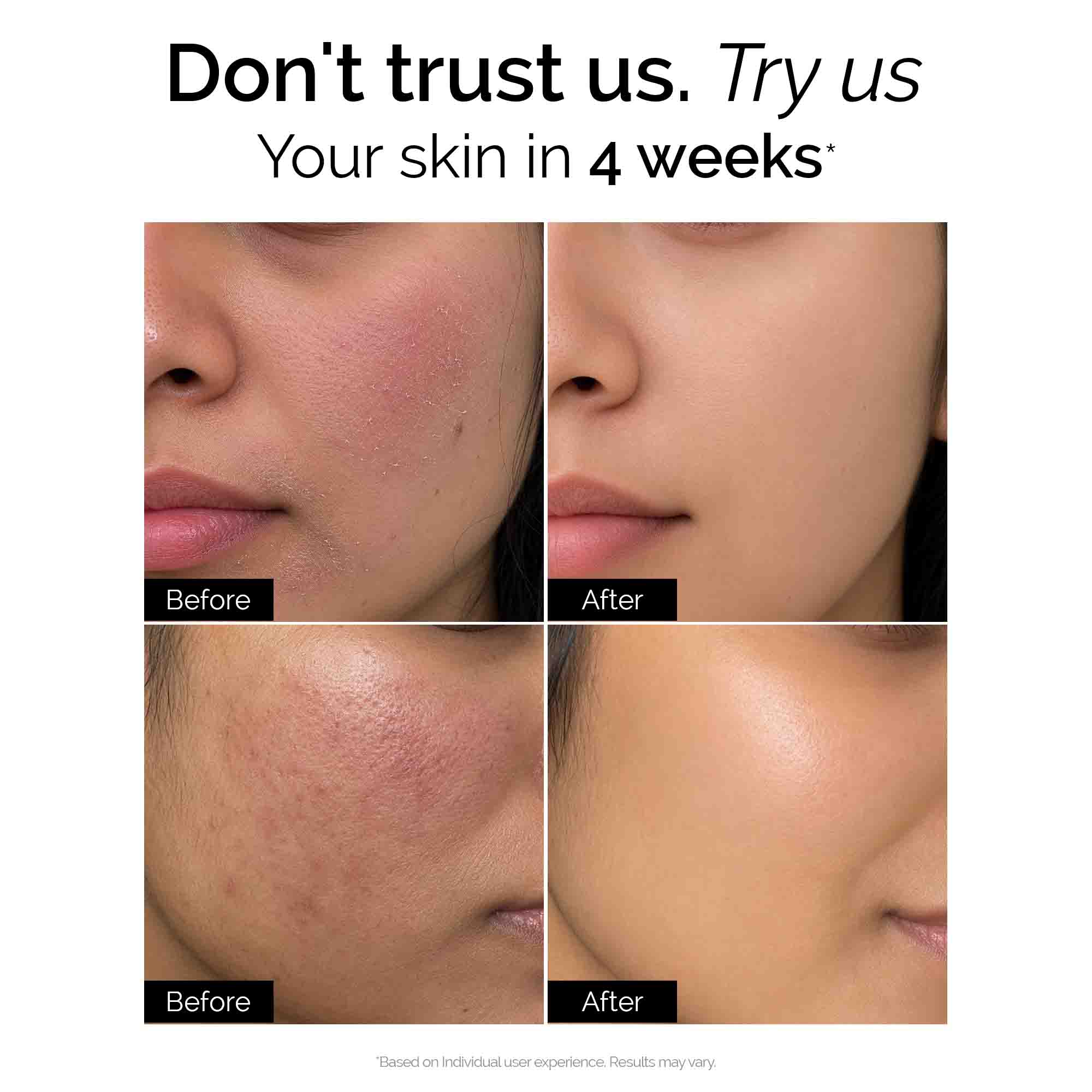 Dry Defence Therapy Trial Kit |  Facewash + Serum + Moisturiser + Sunscreen | for Dry & Sensitive Skin