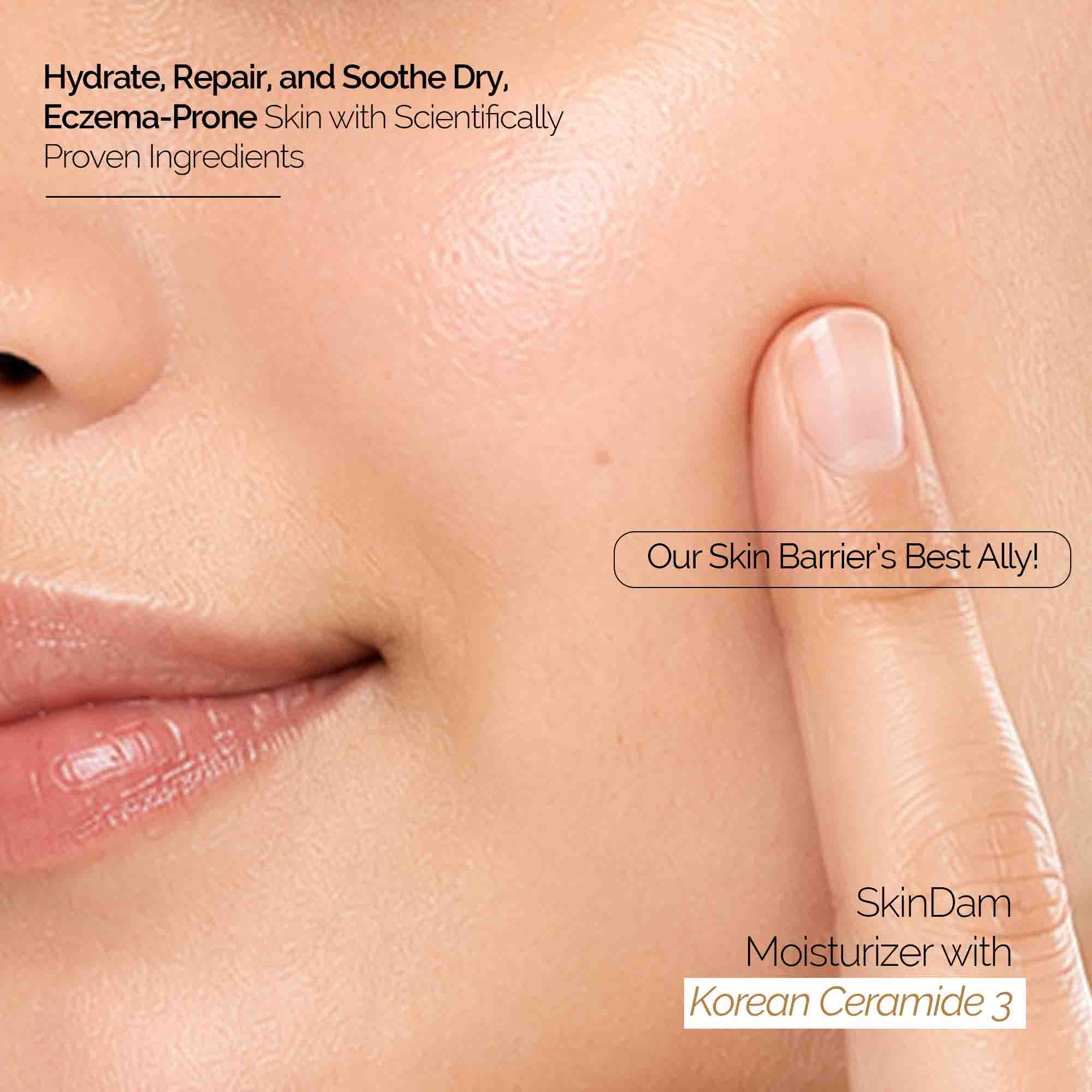 Skindam Barrier-Repair Moisturizer with Ceramides and Oats 50 g