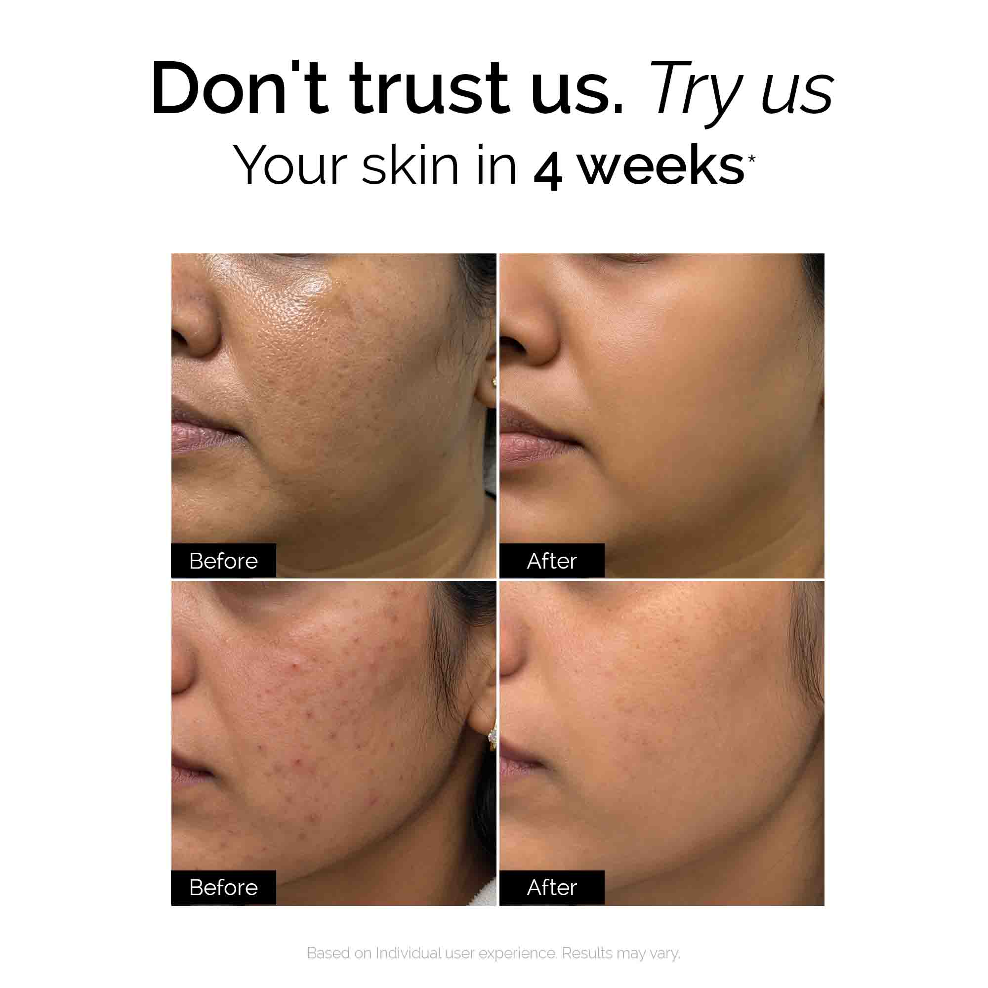 Brightening Therapy Trial Kit | for Oily & Combination Skin | Facewash + Serum + Moisturiser + Sunscreen