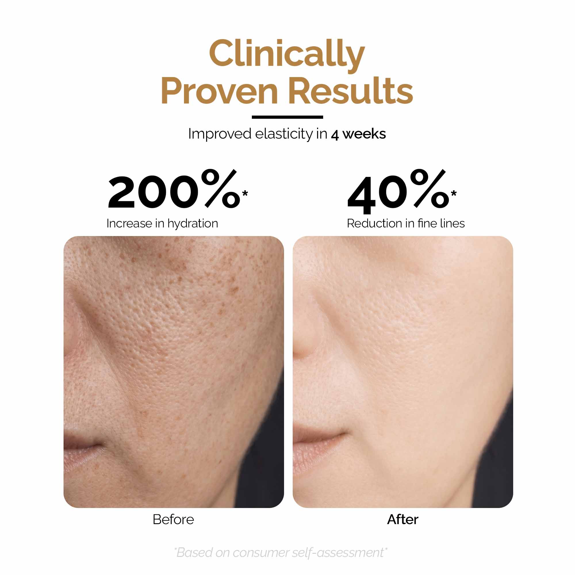Mucin Moist Serum with 9 Kinds of Hyaluronic Acid, 5% Niacinamide, Snail Mucin & Ceramides