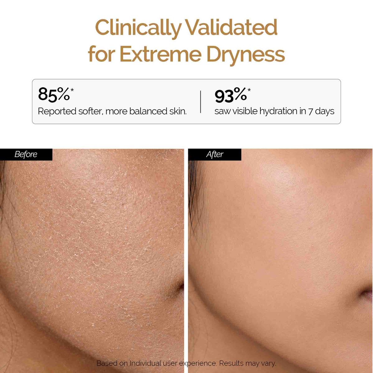 Skindam Barrier-Repair Moisturizer with Ceramides and Oats 50 g