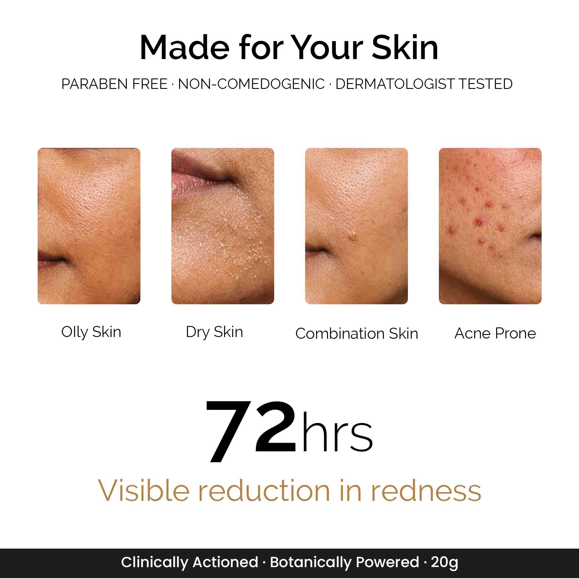 Zitsit Spot Corrector For Active Acne | Acne Scars | Salicylic | Niacinamide | Zinc - Acne Prone & Active Acne | 20g
