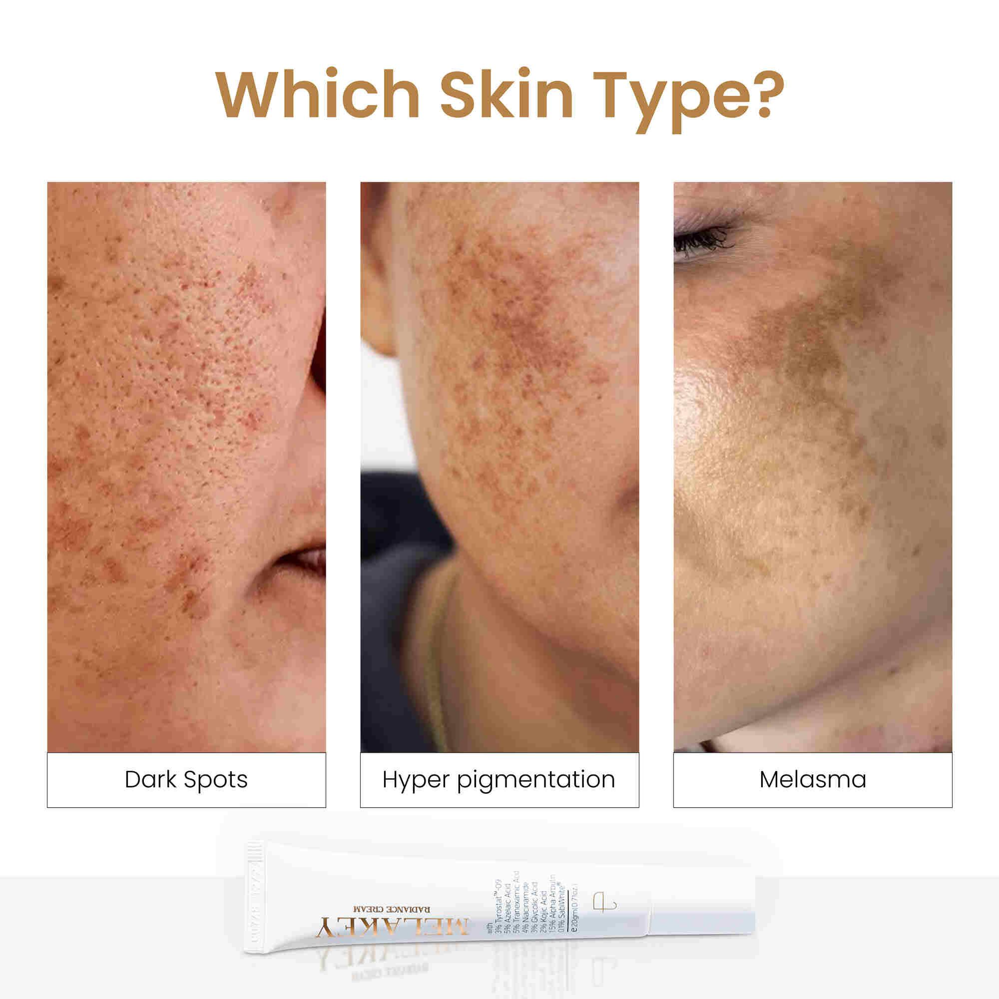 Melakey Dark Spot Corrector with Azelaic Acid 20 g