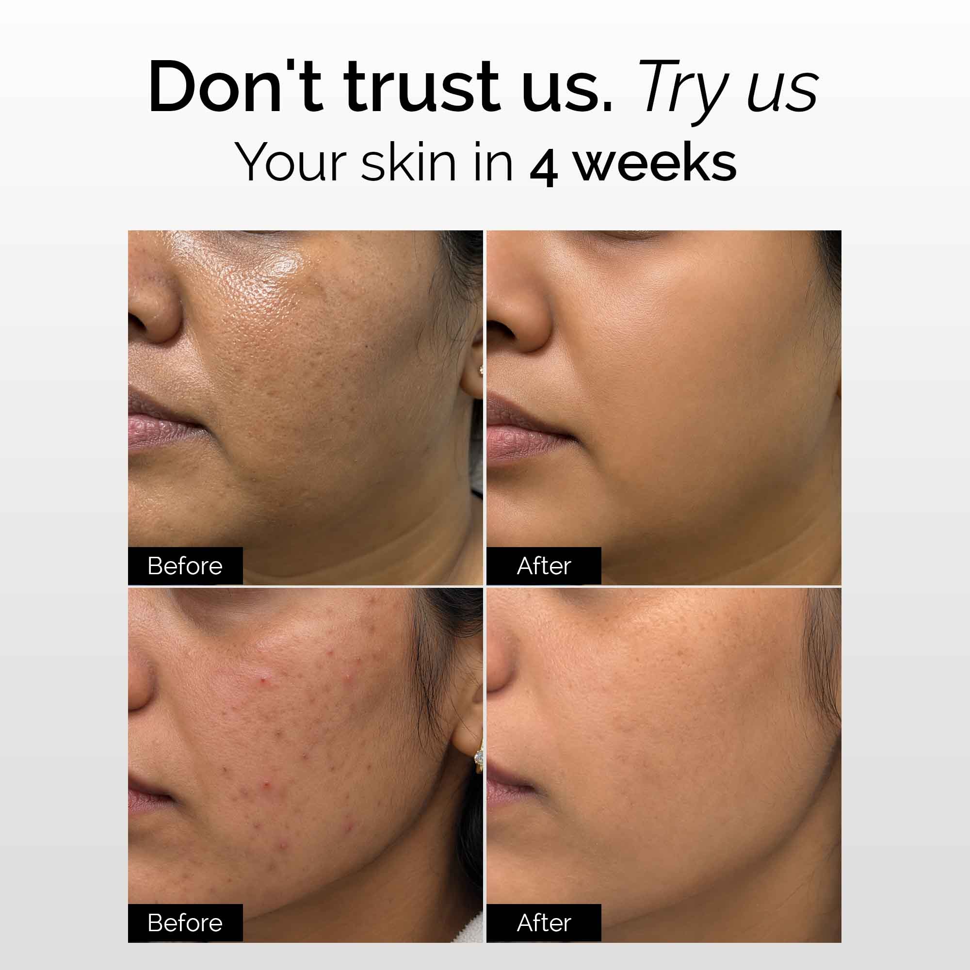 Brightening Therapy Kit - Oily/Combination Skin