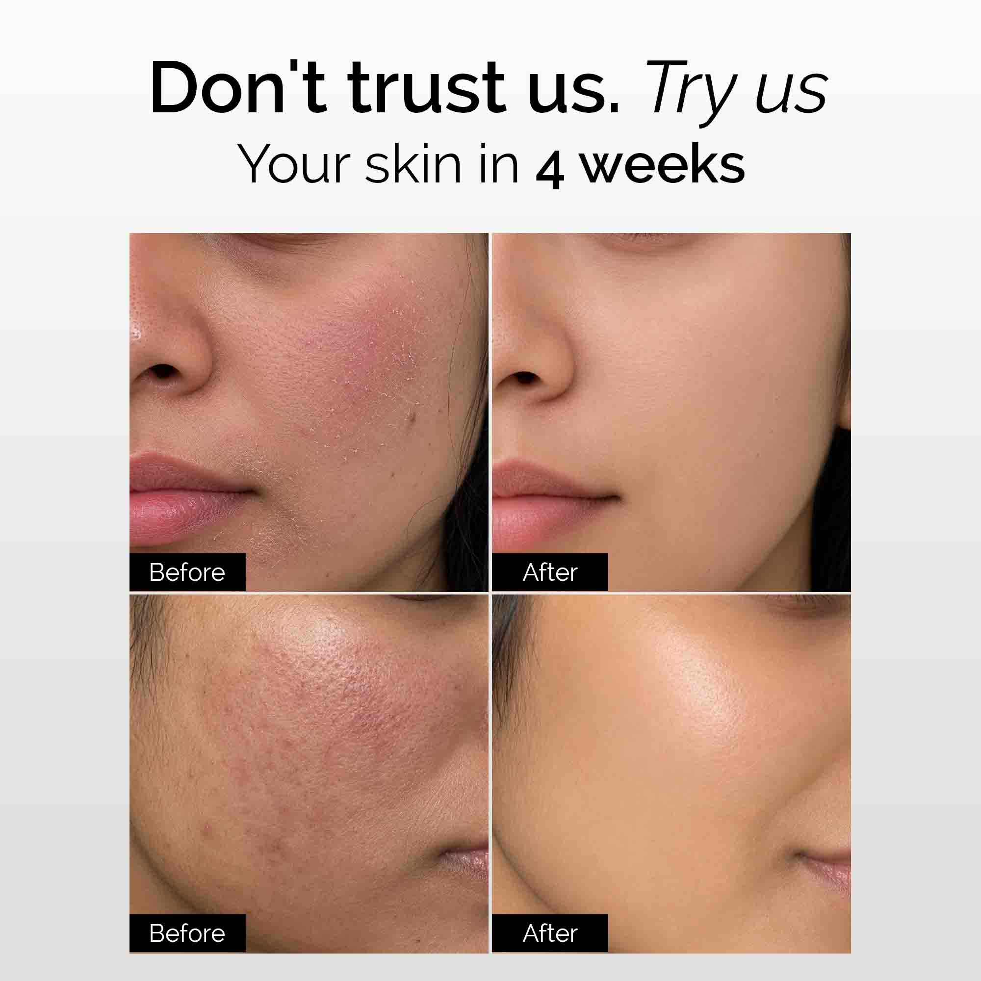 Dry Defence Therapy Kit - Dry/Sensitive Skin