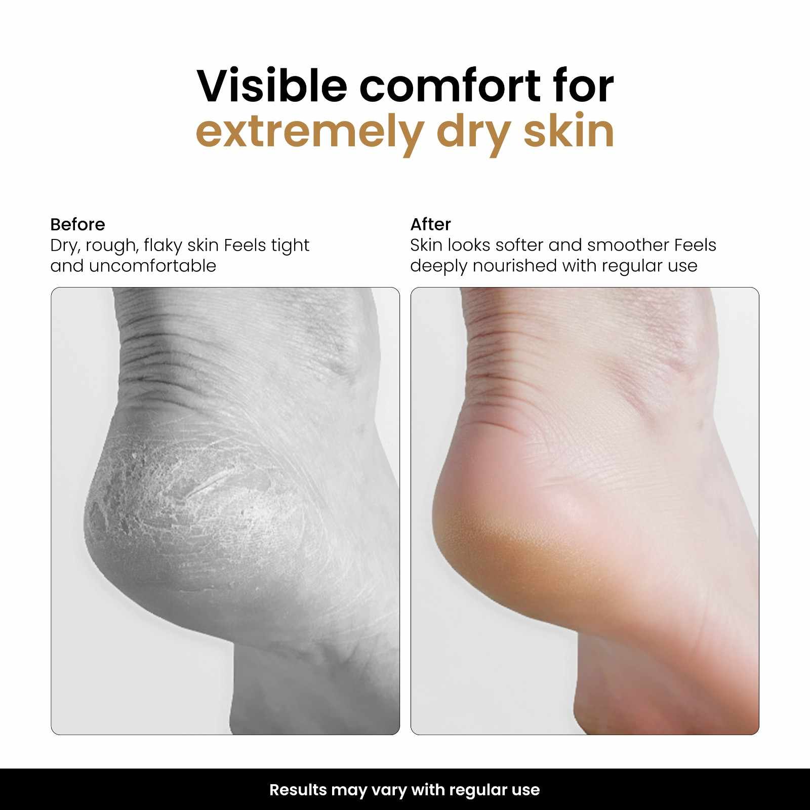 Intenseal Repair Balm with Shea Butter & Vitamin E 50 ml