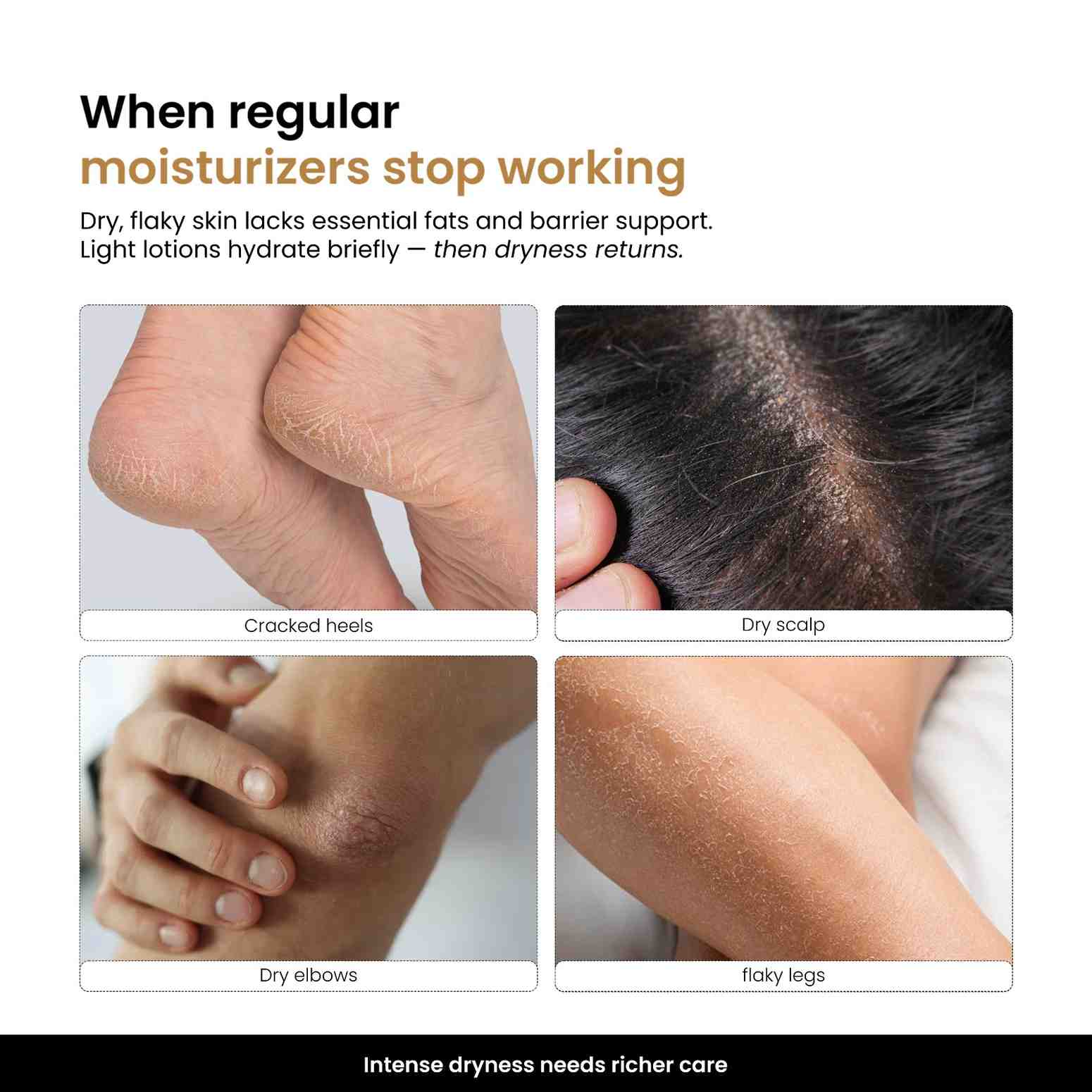 Intenseal Repair Balm with Shea Butter & Vitamin E 50 ml