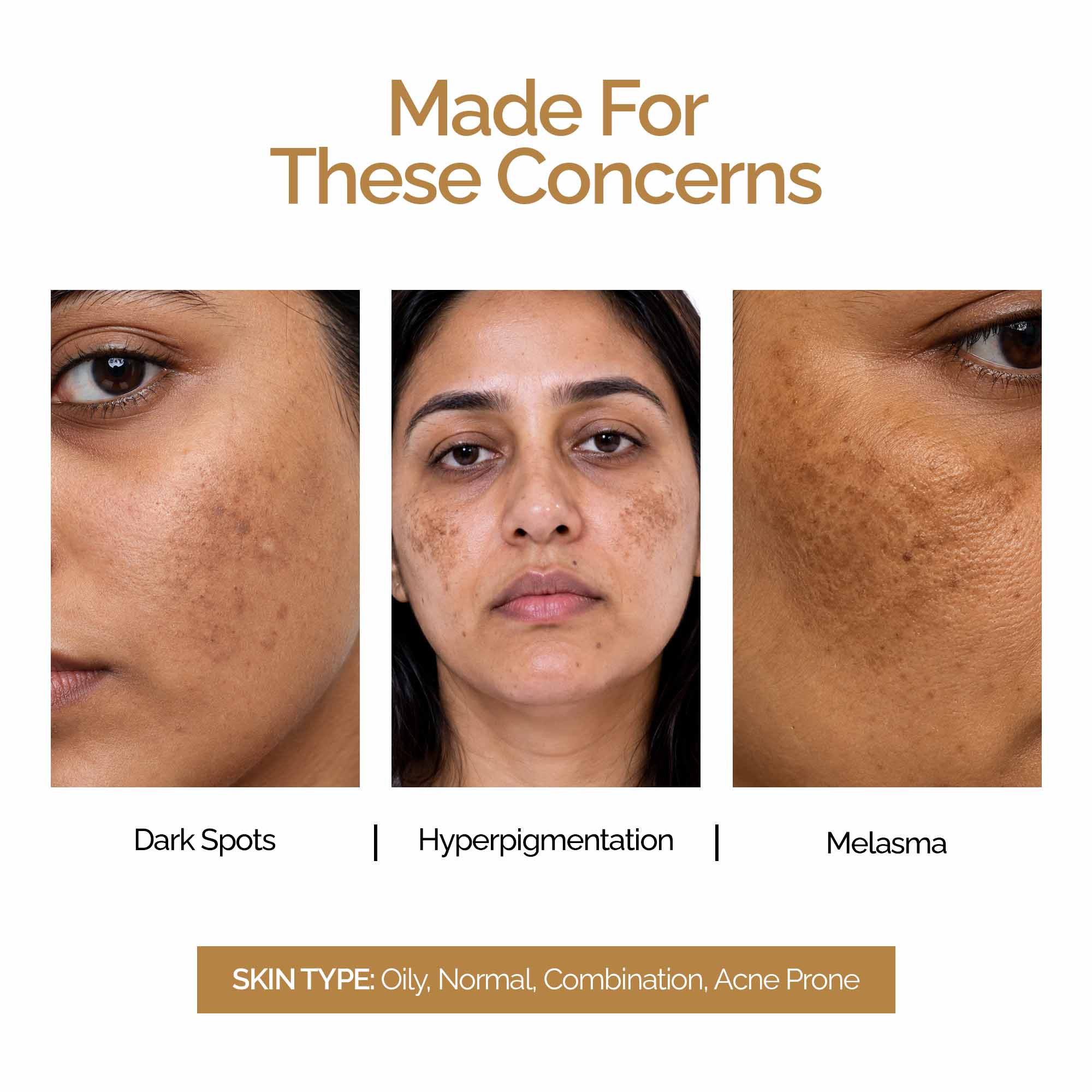 Melakey Face Wash Dark Spots, Pigmentation & Tone Correction | Oily, Normal & Combination Skin 75g