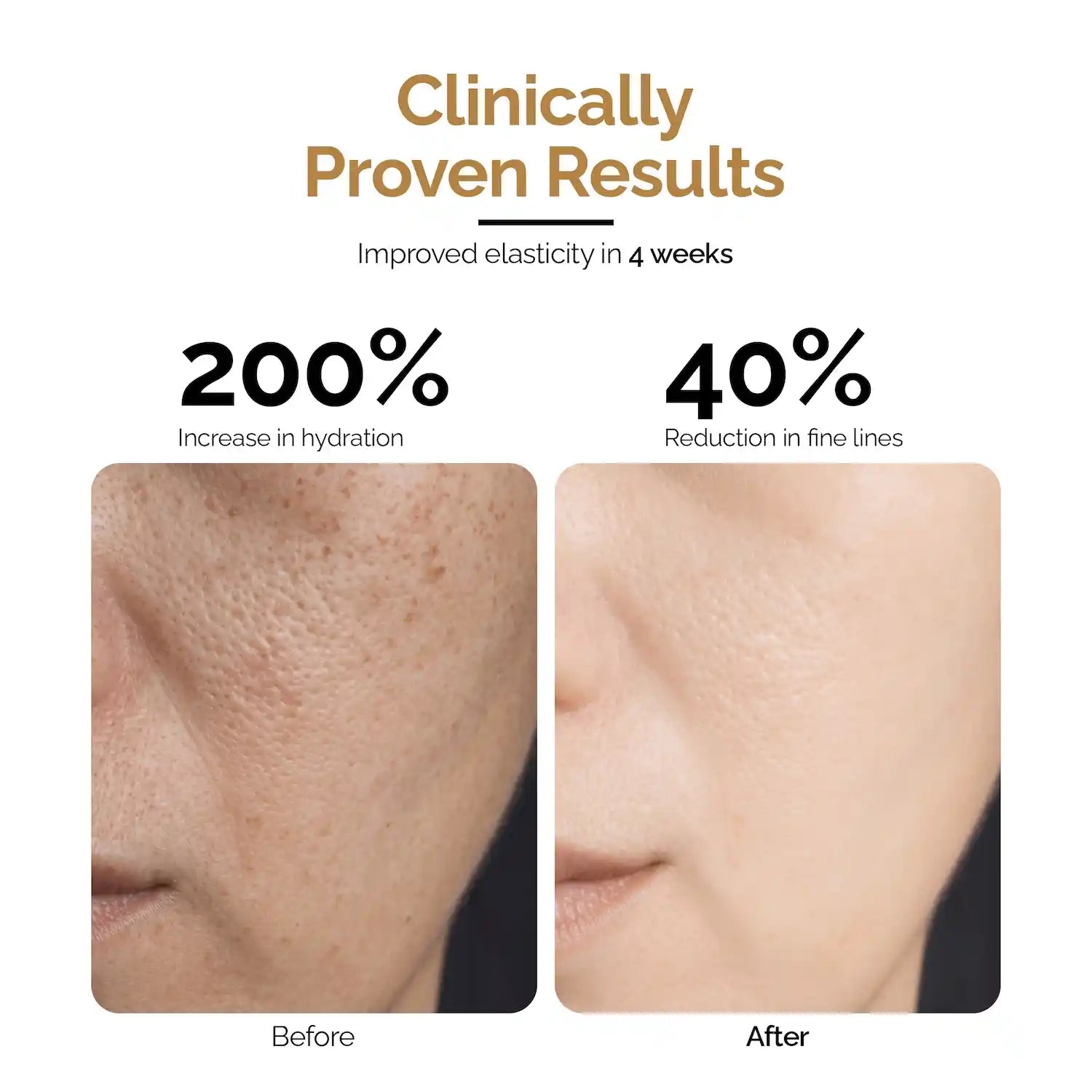 Mucin Moist Serum with 9 Kinds of Hyaluronic Acid, 5% Niacinamide, Snail Mucin & Ceramides