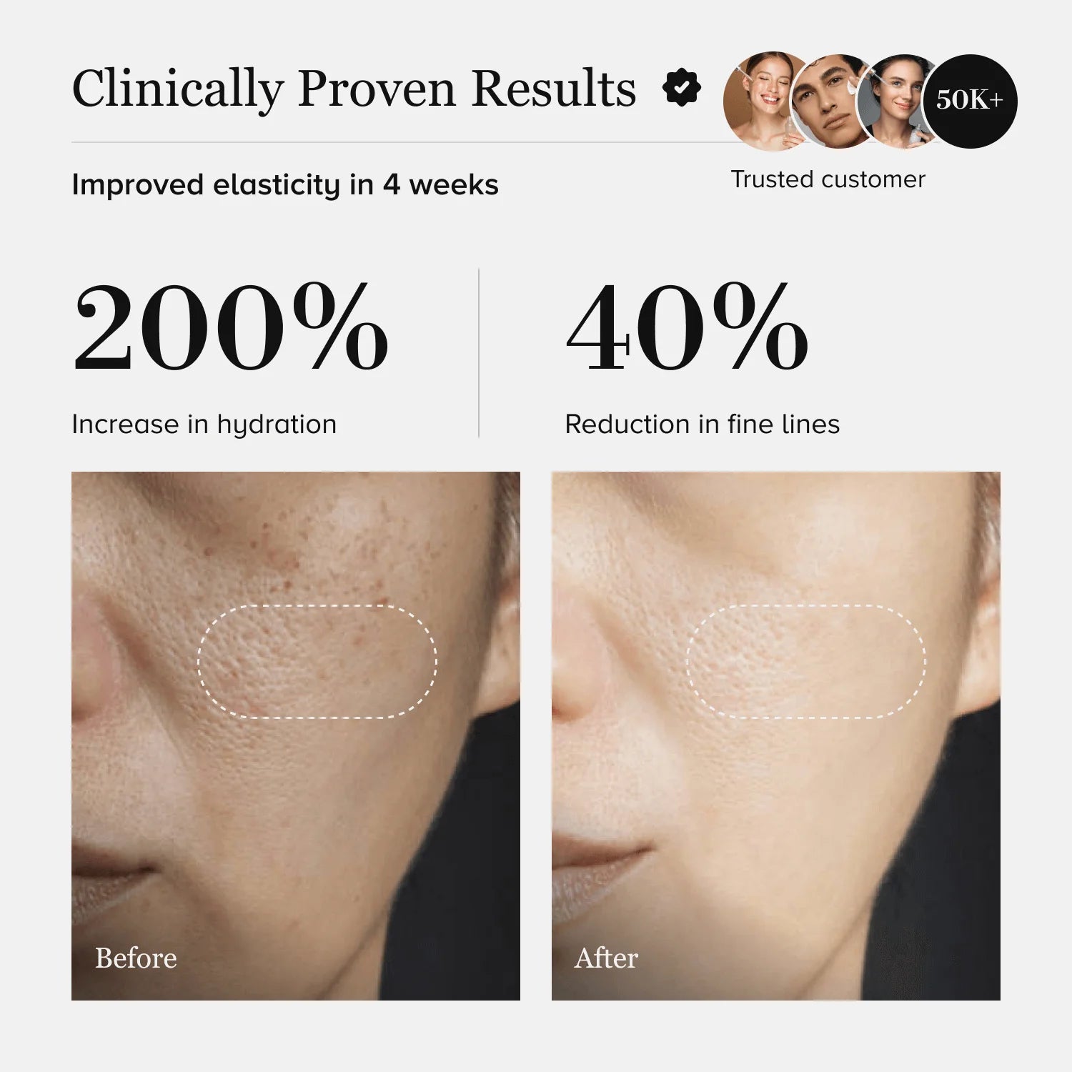 Mucin Moist Serum - World's 1st Snail Mucin | 9 Hyaluronic Acids | Ceramides | Niacinamide - For All Skin Types | 30ml